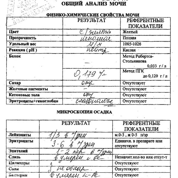 общий анализ мочи